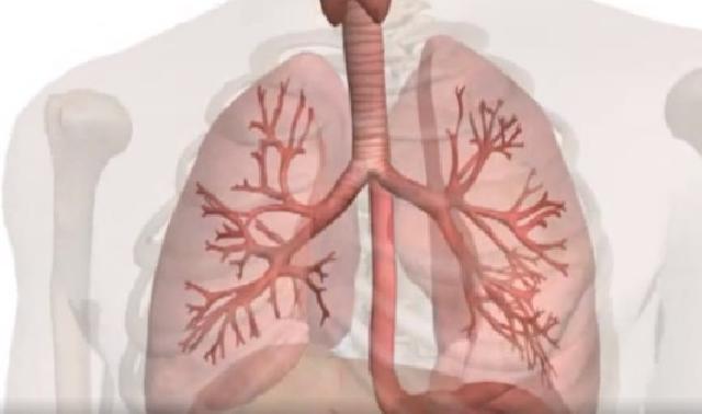İnterstisyel akciğer hastalığı bitkisel destek ürünler